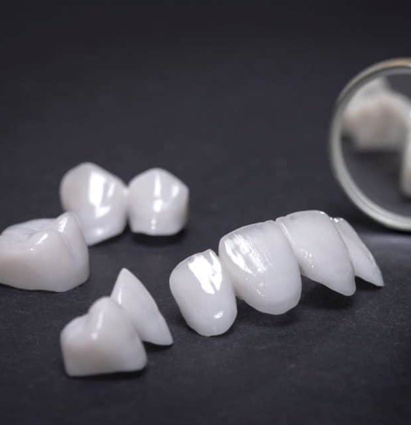 Provisional Restorations in San Jose, CA