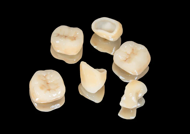 Zirconia Dental Restorations in San Jose, CA