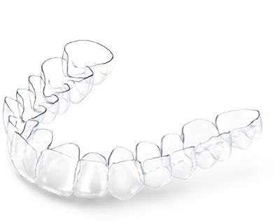 Invisalign San Jose, CA - Arbor Dental Group