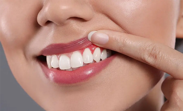 Periodontics - Gum Disease Treatment in San Jose, CA  - Arbor Dental Group