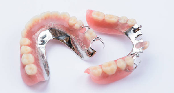 Removable Dentures in San Jose, CA - Arbor Dental Group