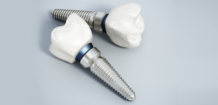 Surgical Stent - Arbor Dental Group - San Jose, CA